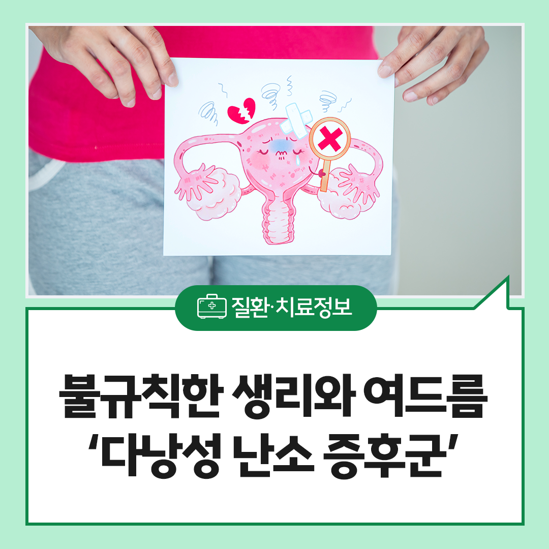 ұĢ , 帧 Ȥ ٳ  ı ȣϱ?