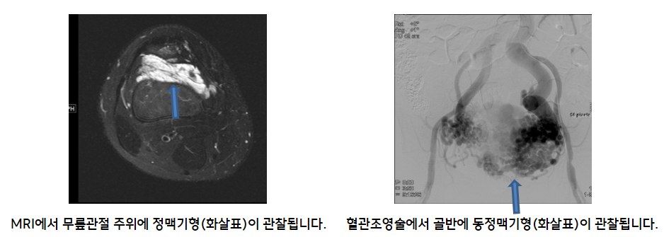 )MRI   Ʊ(ȭǥ) ˴ϴ. ) ݿ Ʊ(ȭǥ) ˴ϴ. 